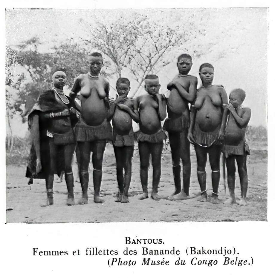 Konzo People